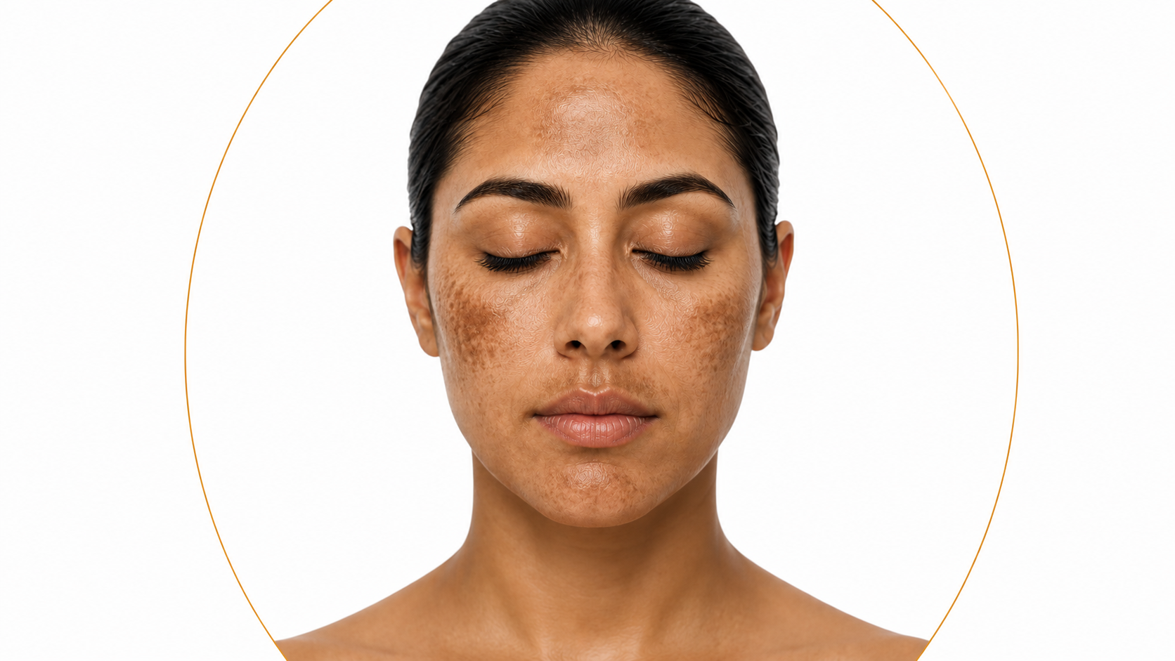 Imagen oficial del evento De lo básico a lo último: Melasma